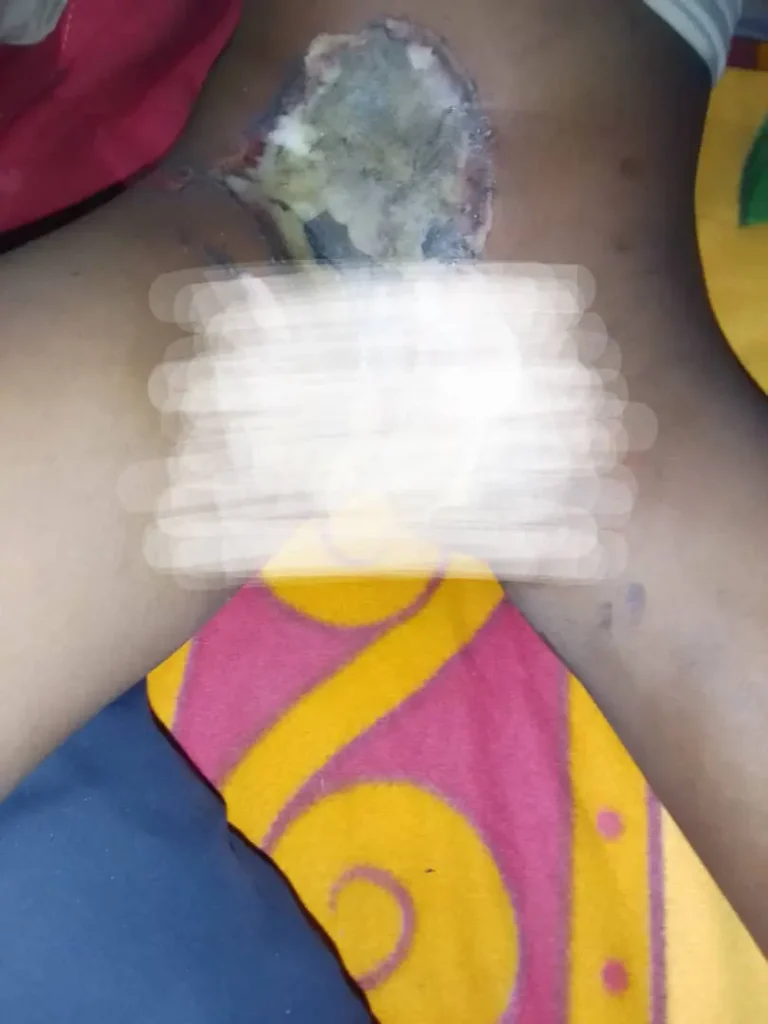 Police arrest woman for burning seven-year-old girl’s private parts over witchcraft allegation