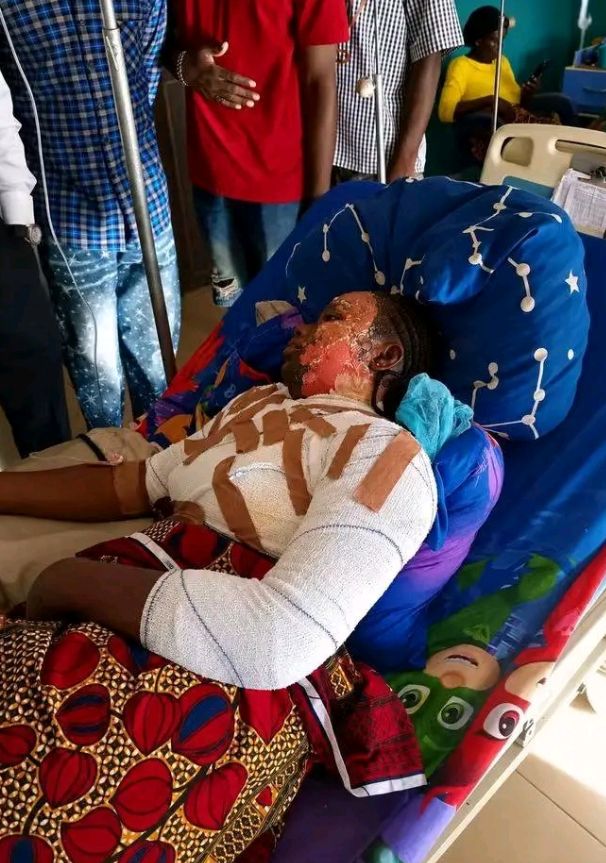 Benue university student arrested for pouring hot water on colleague