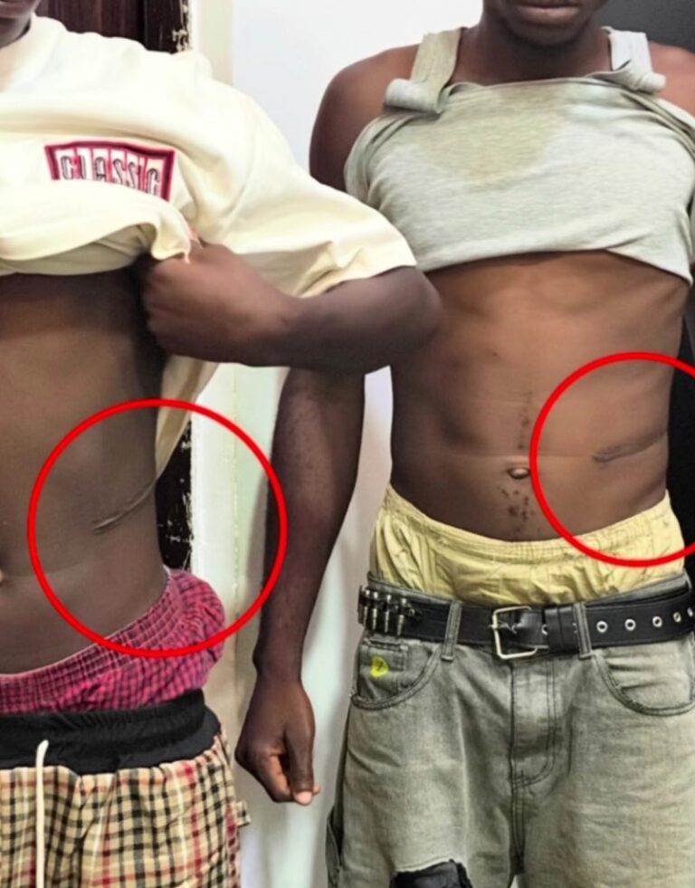 (Video) Police parade medical doctors, others over kidney harvesting at Wellington Hospital